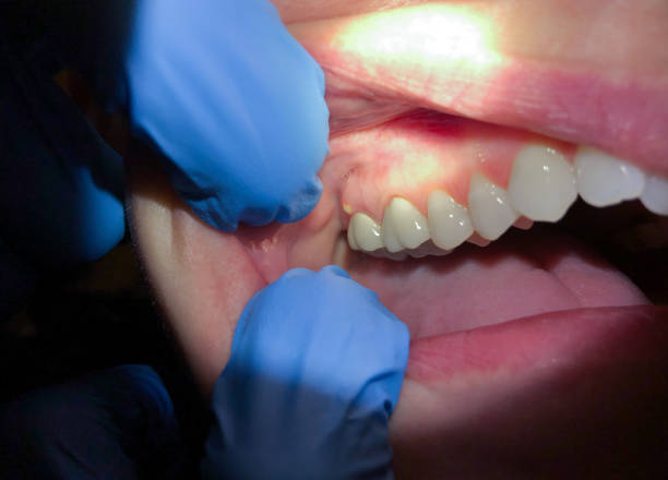 Best After-Hours Dental Trauma Care in North Lewisburg, OH