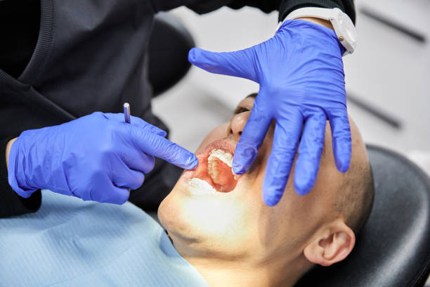Best Emergency Treatment for Dental Infections or Abscesses in North Lewisburg, OH